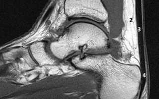 Мышцы голени: анатомия и топ 4 упражнения для передней, латеральной и задней группы