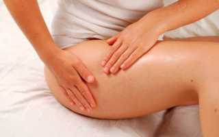 Почему у одних нет растяжек, но это не их заслуга, а вы не виноваты в своих?