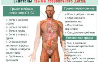 Растяжка поясницы: упражнения для домашних условий