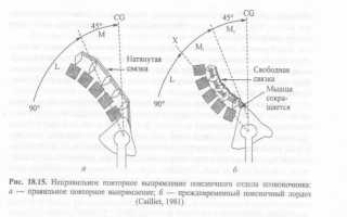 Травмы в бодибилдинге
